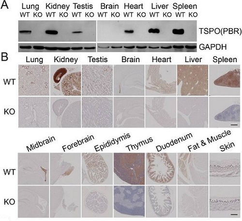 Immunohistochemistry (Formalin/PFA-fixed paraffin-embedded sections) - Anti-PBR antibody [EPR5384] - BSA and Azide free (AB213654), expandable thumbnail