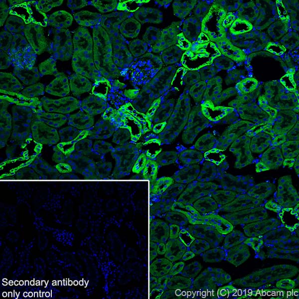 Immunohistochemistry (Frozen sections) - Anti-PBR antibody [EPR5384] - BSA and Azide free (ab213654), expandable thumbnail