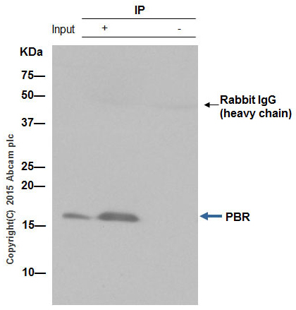 Immunoprecipitation - Anti-PBR antibody [EPR5384] - BSA and Azide free (AB213654), expandable thumbnail