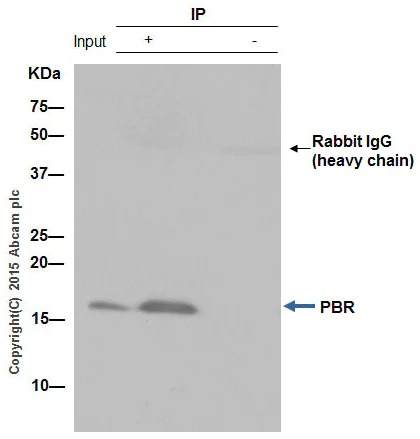Immunoprecipitation - Anti-PBR antibody [EPR5384] - BSA and Azide free (AB213654)