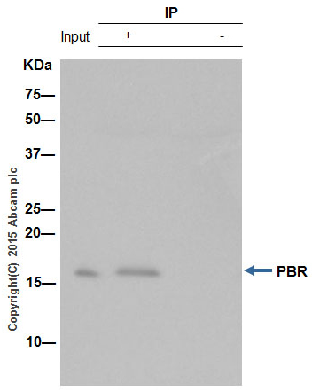 Immunoprecipitation - Anti-PBR antibody [EPR5384] - BSA and Azide free (ab213654), expandable thumbnail