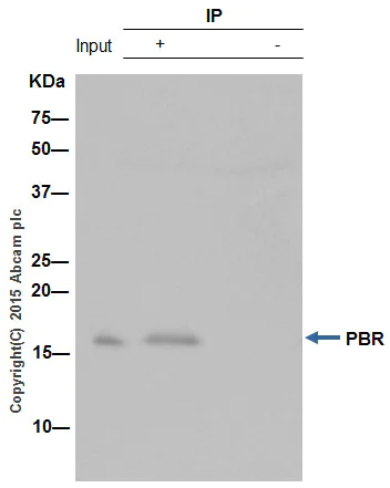 Immunoprecipitation - Anti-PBR antibody [EPR5384] - BSA and Azide free (AB213654)