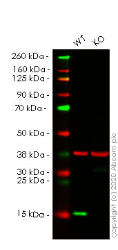 Western blot - Anti-PBR antibody [EPR5384] - BSA and Azide free (AB213654), expandable thumbnail