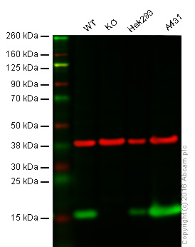Western blot - Anti-PBR antibody [EPR5384] - BSA and Azide free (ab213654), expandable thumbnail