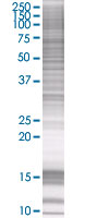 PBR overexpression 293T lysate (whole cell)