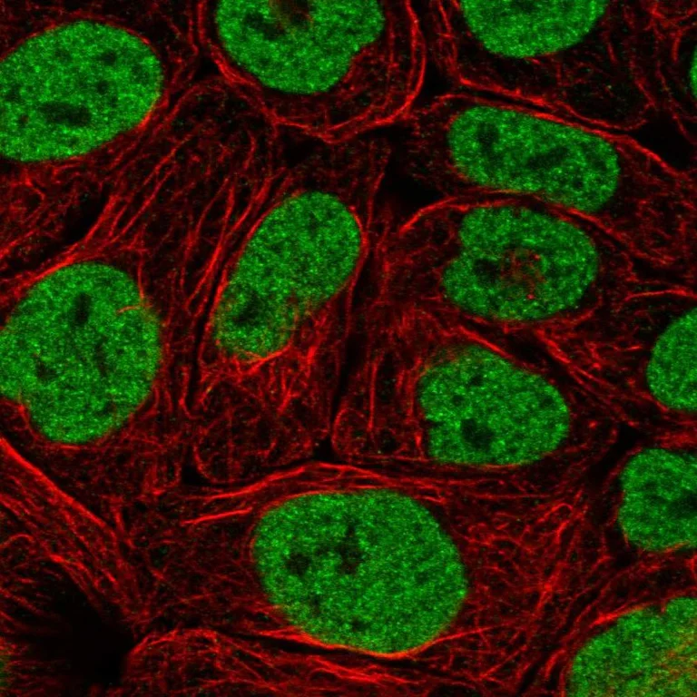 Immunocytochemistry/ Immunofluorescence - Anti-PBRM1 Antibody (AB327250)