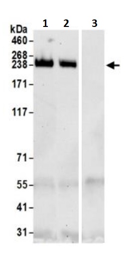 Immunoprecipitation - Anti-PBRM1/BAF180 antibody (AB245399)