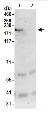 Immunoprecipitation - Anti-PBRM1/BAF180 antibody (AB245399)