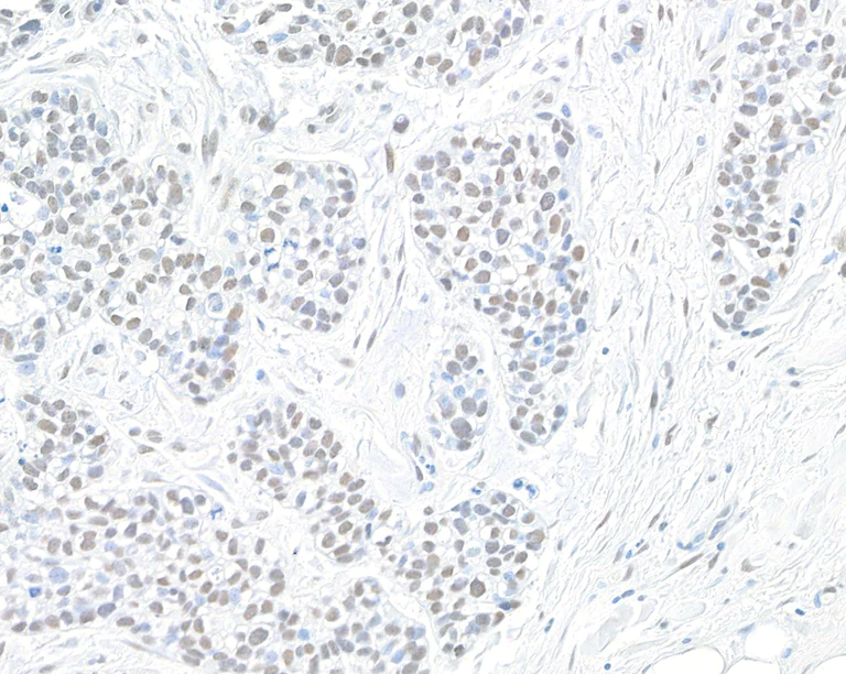 Immunohistochemistry (Formalin/PFA-fixed paraffin-embedded sections) - Anti-PBRM1/BAF180 antibody [BL-39-2C3] (AB243876)
