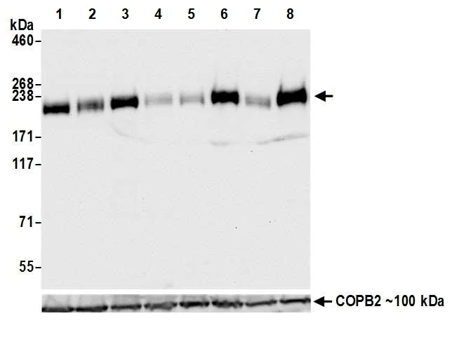 Western blot - Anti-PBRM1/BAF180 antibody [BL-39-2C3] (AB243876)
