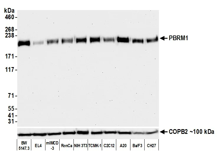 Western blot - Anti-PBRM1/BAF180 antibody [BL-39-2C3] (AB243876)