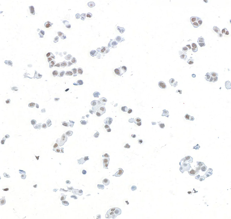Immunocytochemistry - Anti-PBRM1/BAF180 antibody [BL-39-2C3] - BSA free (AB272073)