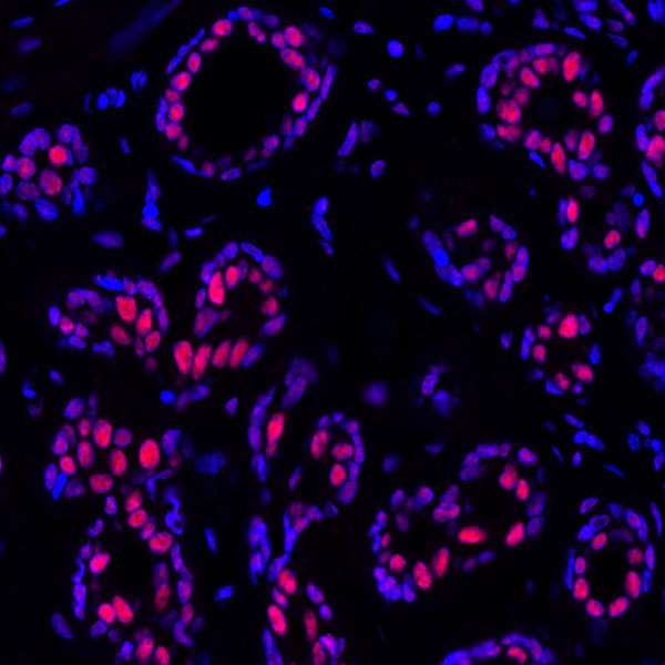 Immunohistochemistry (Formalin/PFA-fixed paraffin-embedded sections) - Anti-PBRM1/BAF180 antibody [BL-39-2C3] - BSA free (AB272073)