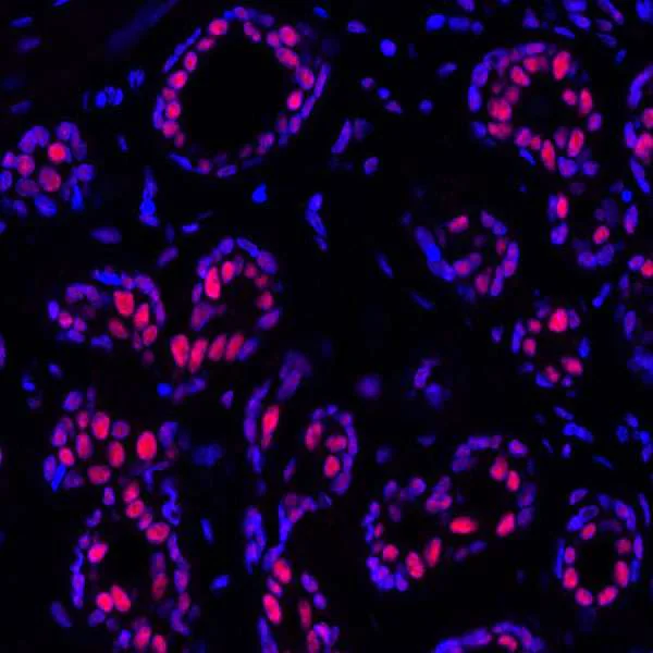 Immunohistochemistry (Formalin/PFA-fixed paraffin-embedded sections) - Anti-PBRM1/BAF180 antibody [BL-39-2C3] - BSA free (AB272073)