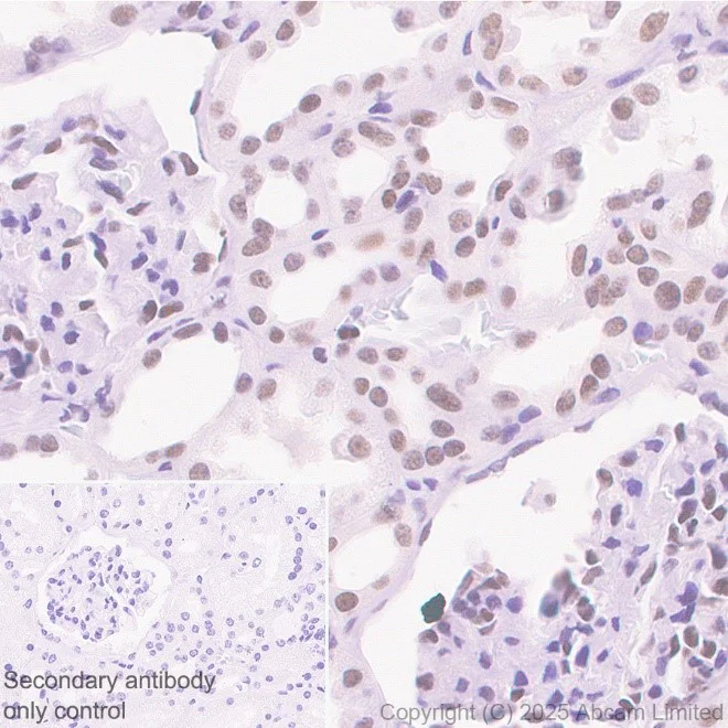 Immunohistochemistry (Formalin/PFA-fixed paraffin-embedded sections) - Anti-PBRM1/BAF180 antibody [EPR15860] (AB196022)