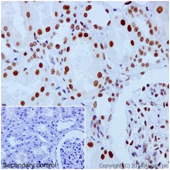 Immunohistochemistry (Formalin/PFA-fixed paraffin-embedded sections) - Anti-PBRM1/BAF180 antibody [EPR15860] (AB196022), expandable thumbnail