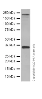 Western blot - Anti-PBRM1/BAF180 antibody [EPR15860] (AB196022)
