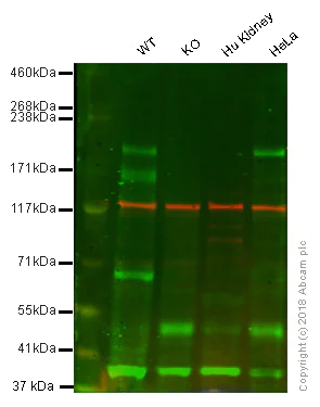 Western blot - Anti-PBRM1/BAF180 antibody [EPR15860] (AB196022)