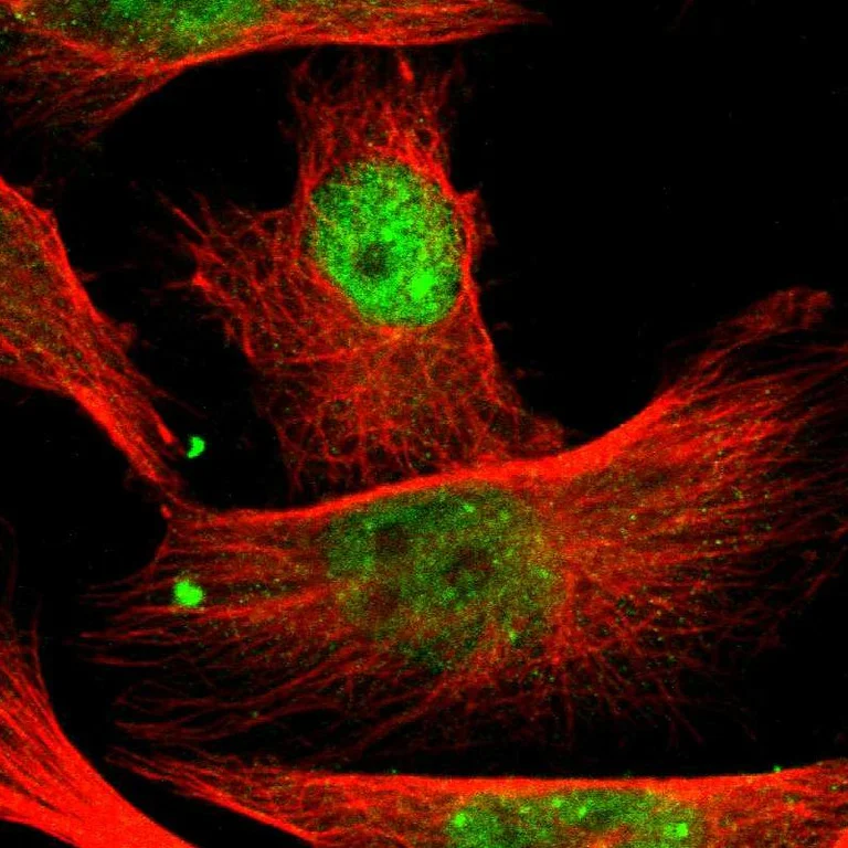 Immunocytochemistry/ Immunofluorescence - Anti-PBX1 Antibody (AB327180)
