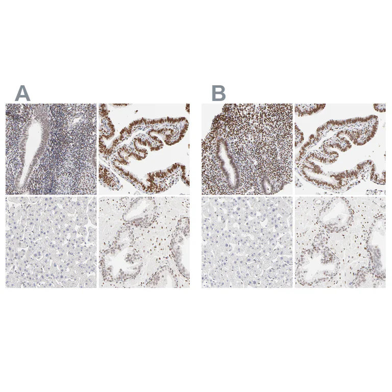 Immunohistochemistry (Formalin/PFA-fixed paraffin-embedded sections) - Anti-PBX1 Antibody (AB327180)