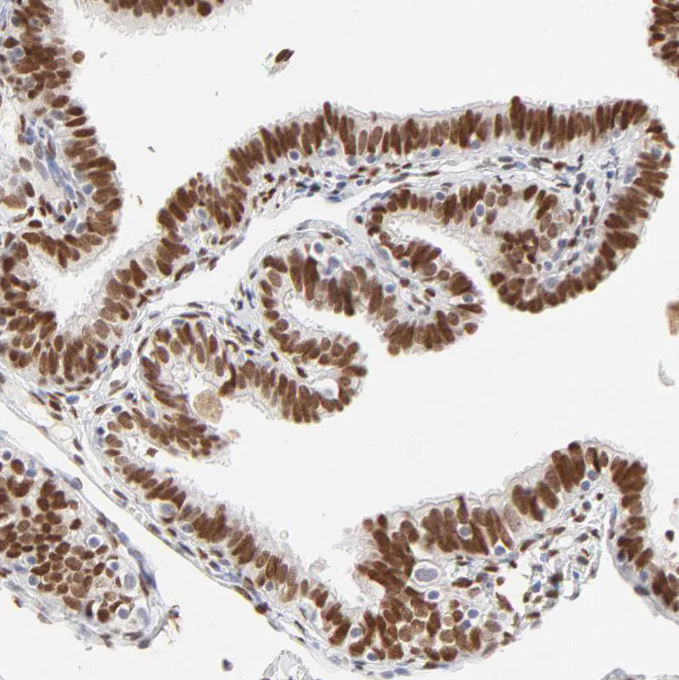 Immunohistochemistry (Formalin/PFA-fixed paraffin-embedded sections) - Anti-PBX1 Antibody (AB327180)