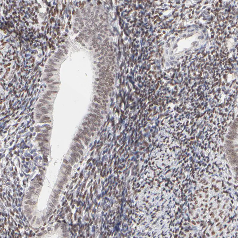 Immunohistochemistry (Formalin/PFA-fixed paraffin-embedded sections) - Anti-PBX1 Antibody (AB327180)