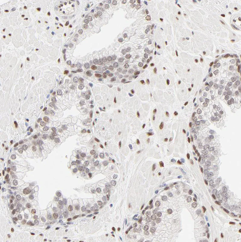 Immunohistochemistry (Formalin/PFA-fixed paraffin-embedded sections) - Anti-PBX1 Antibody (AB327180)