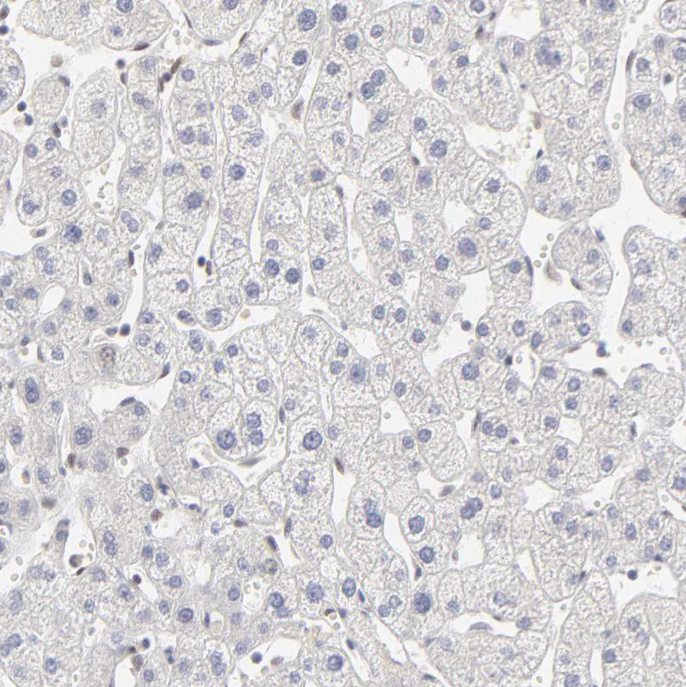 Immunohistochemistry (Formalin/PFA-fixed paraffin-embedded sections) - Anti-PBX1 Antibody (AB327180)