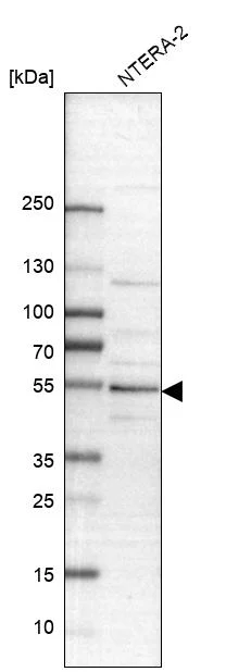 Western blot - Anti-PBX1 Antibody (AB327180)