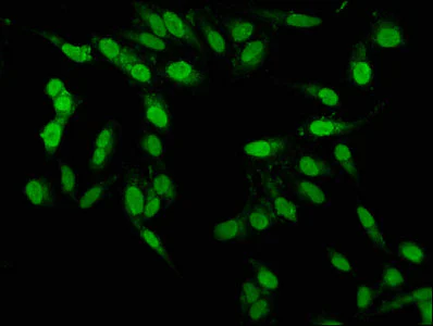 Immunocytochemistry/ Immunofluorescence - Anti-PBX1/PRL antibody (AB236911)