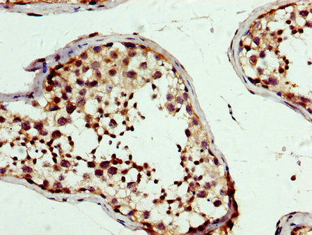 Immunohistochemistry (Formalin/PFA-fixed paraffin-embedded sections) - Anti-PBX1/PRL antibody (AB236911)