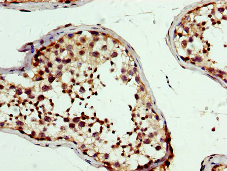 Immunohistochemistry (Formalin/PFA-fixed paraffin-embedded sections) - Anti-PBX1/PRL antibody (AB236911)