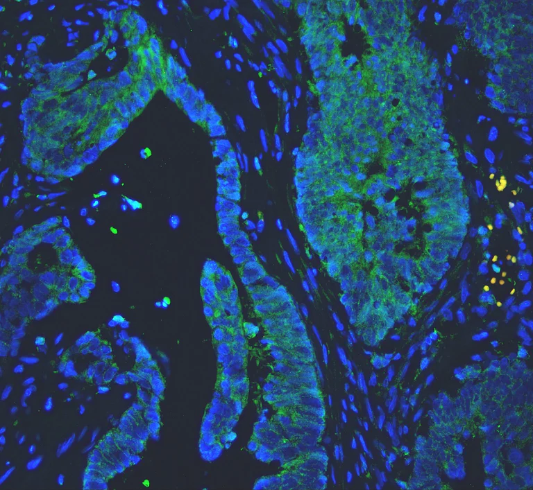 Immunohistochemistry (Formalin/PFA-fixed paraffin-embedded sections) - Anti-PC1/3 antibody (AB191452)