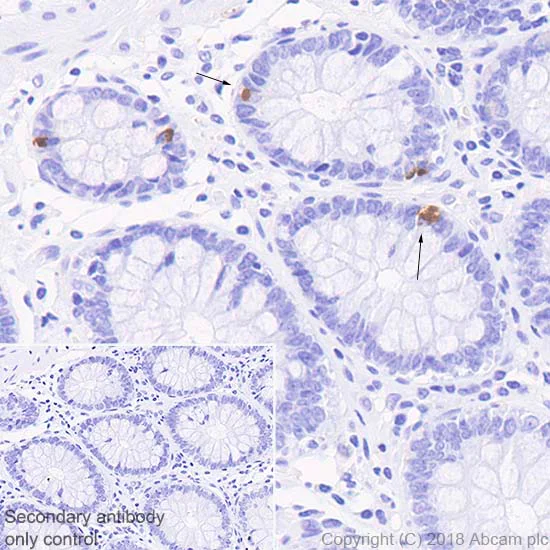 Immunohistochemistry (Formalin/PFA-fixed paraffin-embedded sections) - Anti-PC1/3 antibody [EPR21908] (AB220363)