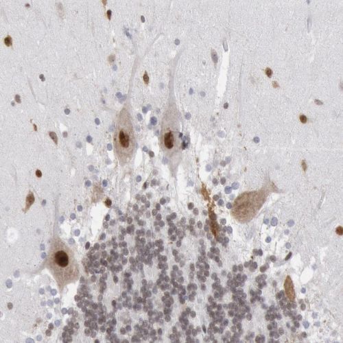 Immunohistochemistry (Formalin/PFA-fixed paraffin-embedded sections) - Anti-PC4 antibody (AB244248), expandable thumbnail