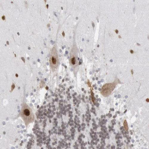 Immunohistochemistry (Formalin/PFA-fixed paraffin-embedded sections) - Anti-PC4 antibody (AB244248)