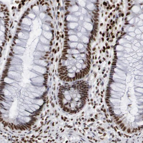 Immunohistochemistry (Formalin/PFA-fixed paraffin-embedded sections) - Anti-PC4 antibody (AB244248), expandable thumbnail