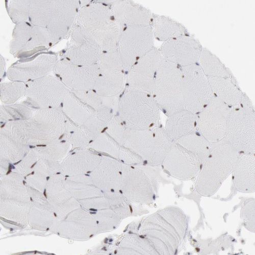 Immunohistochemistry (Formalin/PFA-fixed paraffin-embedded sections) - Anti-PC4 antibody (ab244248), expandable thumbnail