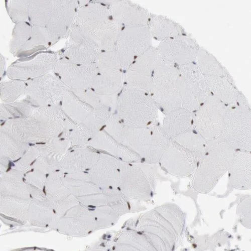 Immunohistochemistry (Formalin/PFA-fixed paraffin-embedded sections) - Anti-PC4 antibody (AB244248)