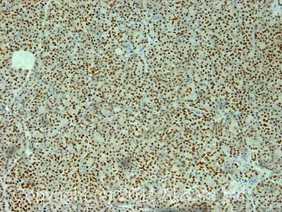 Immunohistochemistry (Formalin/PFA-fixed paraffin-embedded sections) - Anti-PC4 antibody (AB72132), expandable thumbnail