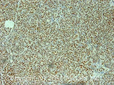 Immunohistochemistry (Formalin/PFA-fixed paraffin-embedded sections) - Anti-PC4 antibody (AB72132)