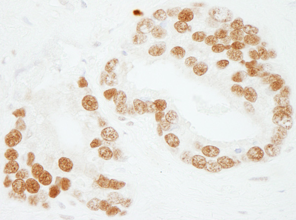 Immunohistochemistry (Formalin/PFA-fixed paraffin-embedded sections) - Anti-PC4 antibody (AB72132), expandable thumbnail