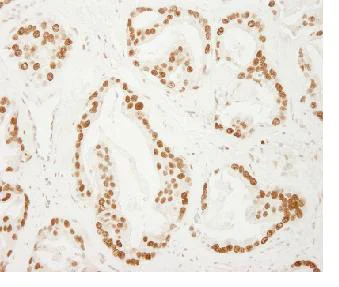 Immunohistochemistry (Formalin/PFA-fixed paraffin-embedded sections) - Anti-PC4 antibody (AB84459)
