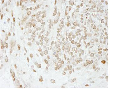 Immunohistochemistry (Formalin/PFA-fixed paraffin-embedded sections) - Anti-PC4 antibody (AB84459)