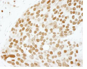 Immunohistochemistry (Formalin/PFA-fixed paraffin-embedded sections) - Anti-PC4 antibody (AB84459)