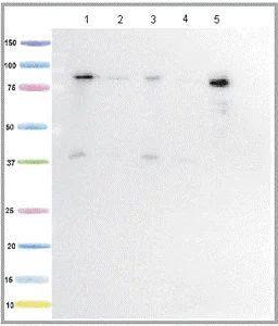 Western blot - Anti-PCB antibody [10G7BF7] (AB123451)