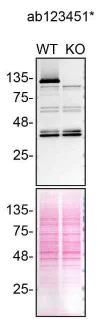 Western blot - Anti-PCB antibody [10G7BF7] (AB123451)