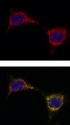 Immunocytochemistry/ Immunofluorescence - Anti-PCB antibody [3H2AD9] (AB110314), expandable thumbnail