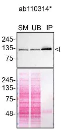 Immunoprecipitation - Anti-PCB antibody [3H2AD9] (AB110314)