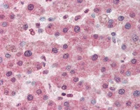 Immunohistochemistry (Formalin/PFA-fixed paraffin-embedded sections) - Anti-PCB antibody (AB115579)